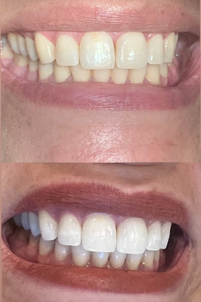 Foto 2 de Dra Giulia Augustineli - Dentista em Santana/zona norte sp