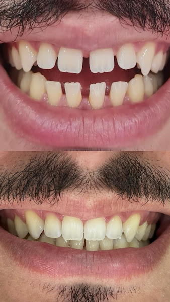 Foto 3 de Dra Giulia Augustineli - Dentista em Santana/zona norte sp