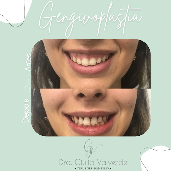 Foto 2 de Dra. Giulia Valverde | Dentista em Barueri