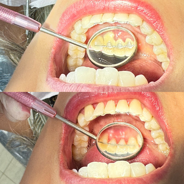 Foto 3 de Dra Giullia Mantovani - Dentista no ABC