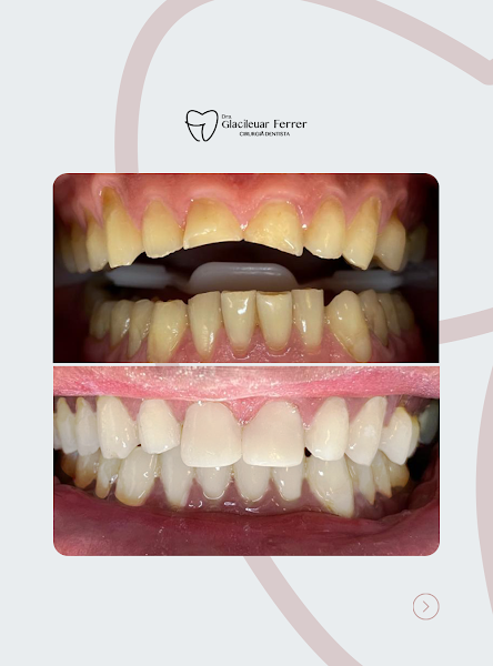 Foto 3 de Dra. Guacileuar - Dentista