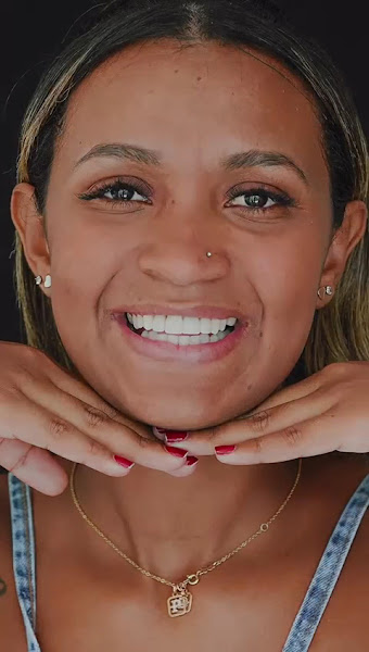 Foto 3 de Dra Helen Carneiro - Reabilitação oral na Barra da Tijuca