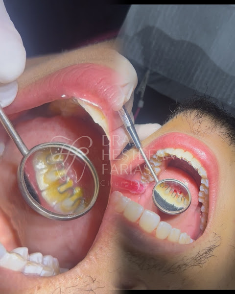 Foto 2 de Dra. Hestefany Farias – Limpeza e Clareamento Dental em Vitória ES