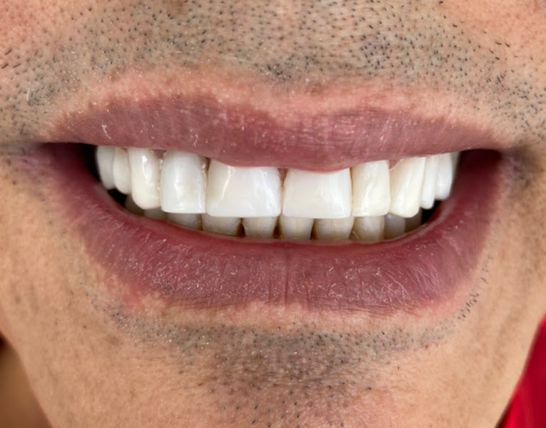 Foto 2 de Dra. Iana Inhamuns Consultório Odontológico