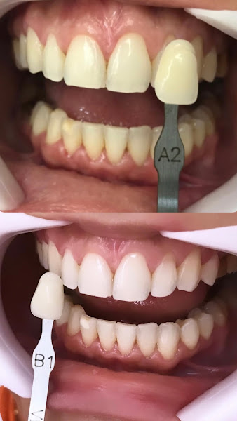 Foto 3 de Dra Iane Carneiro