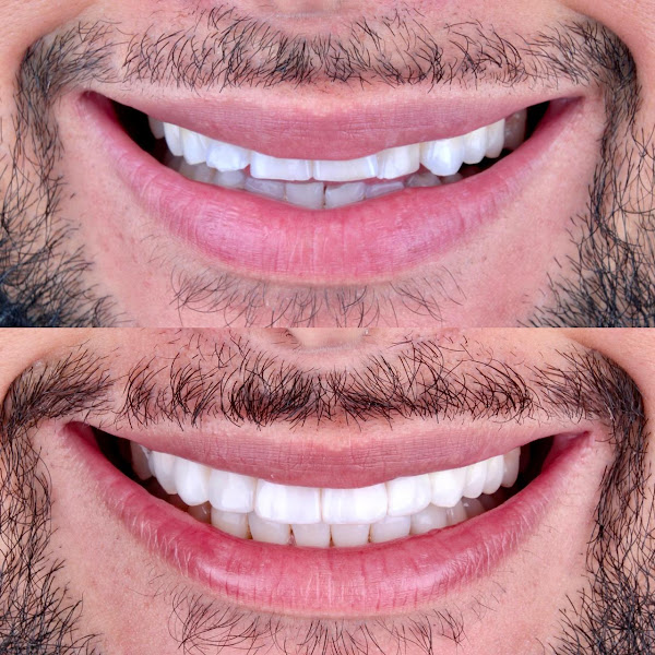 Foto 2 de Dra Iasmine Duarte