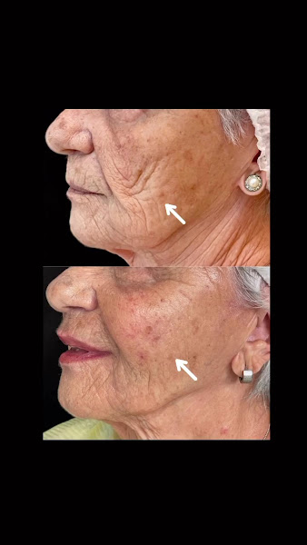 Foto 3 de Dra Ignez Costa Ayres - Harmonização Facial