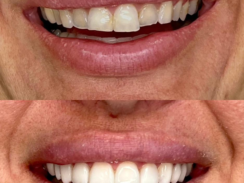 Foto 5 de Dra. Ilana Pais | Dentista e Odontologia Estética