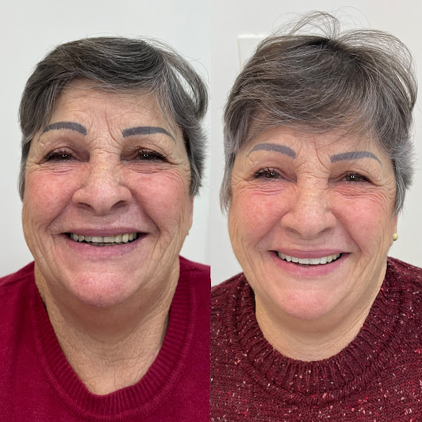 Foto 3 de Dra. Indianara Gaboardi - Cirurgiã-Dentista