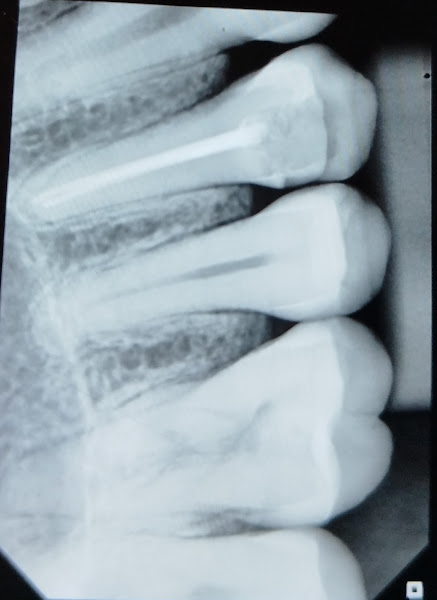 Foto 3 de Dra. Ingrid Brandão cirurgiã Dentista