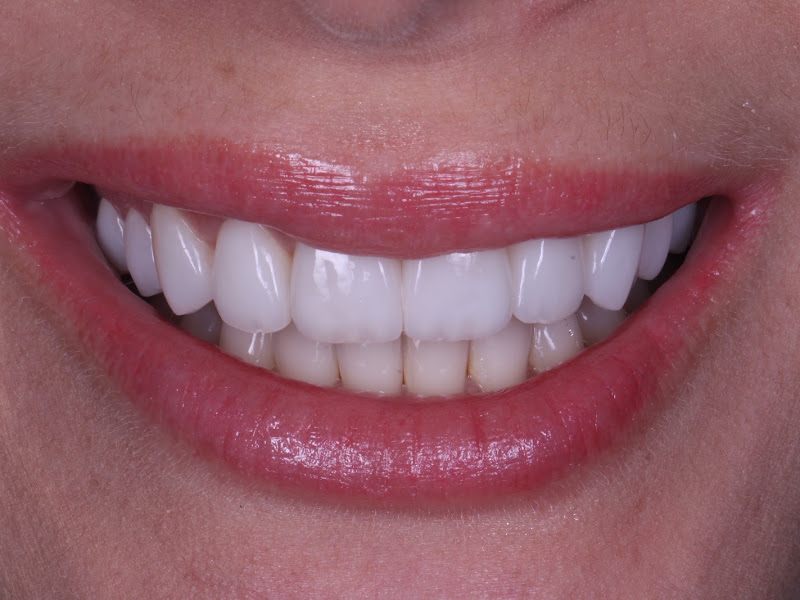 Foto 3 de Dra. Ingrid F. Zöll Gonçalves, Dentista