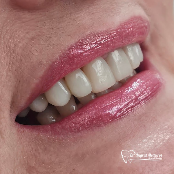Foto 3 de Dra. Ingrid Medeiros dentista Protesista em João Pessoa