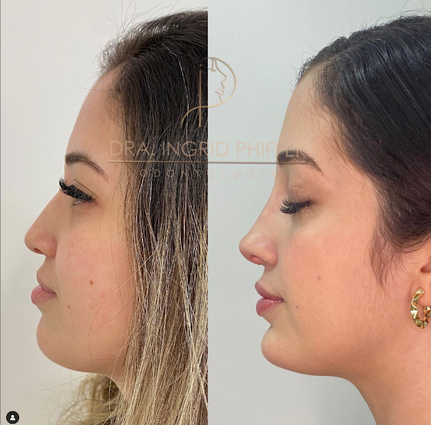 Foto 3 de Dra. Ingrid Phiffer