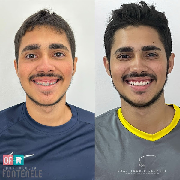 Foto 3 de Dra. Ingrid Segatti - DENTISTA EM DIADEMA