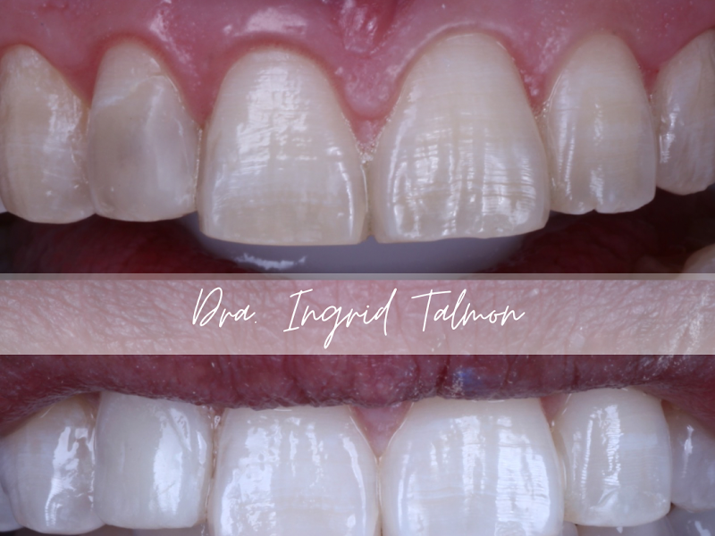 Foto de Dra. Ingrid Talmon- Dentista em Recife (Boa Viagem)