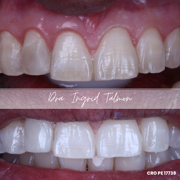 Foto 2 de Dra. Ingrid Talmon- Dentista em Recife (Boa Viagem)