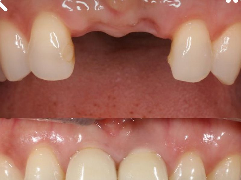 Foto 3 de Dra.Ingrid Villarraso Odontologia - Guarulhos