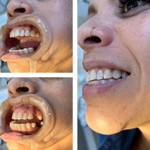 Foto 3 de Dra. Isabel Reis - Cirurgiã Dentista