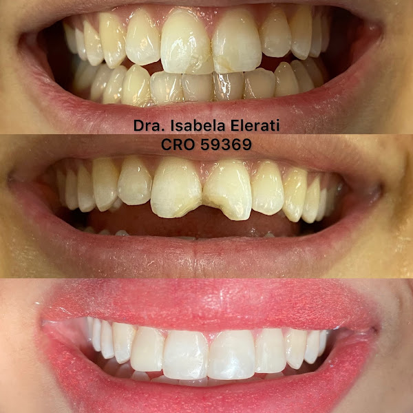 Foto 3 de Dra. Isabela Elerati