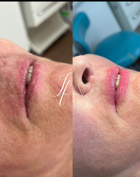 Foto 2 de Dra Isabela Fidelis - Odontologia e harmonização