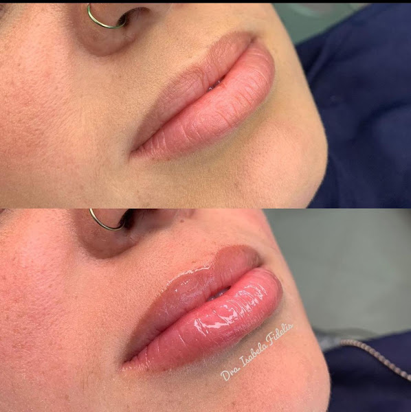 Foto 3 de Dra Isabela Fidelis - Odontologia e harmonização