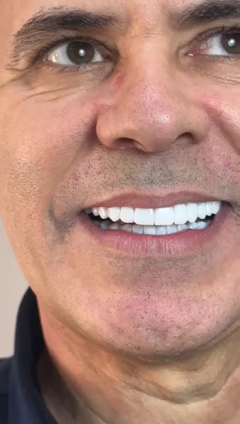 Foto 3 de Dra Isabela Garcia⁠ | Dentista | Faceta em Resina | SJC