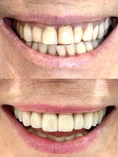 Foto 3 de Dra. Isabela Lisboa - Próteses, Facetas e Implantes