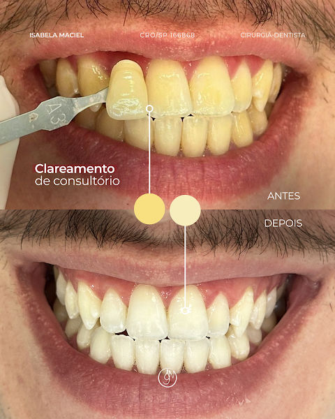 Foto 3 de Dra. Isabela Maciel | Clareamento dental, Restaurações, Tratamento de canal