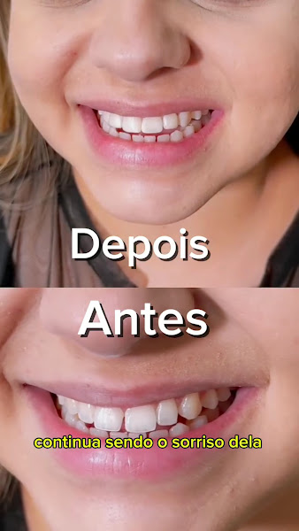 Foto 3 de Dra Isabela Maciel | Dentista em Campos dos Goytacazes