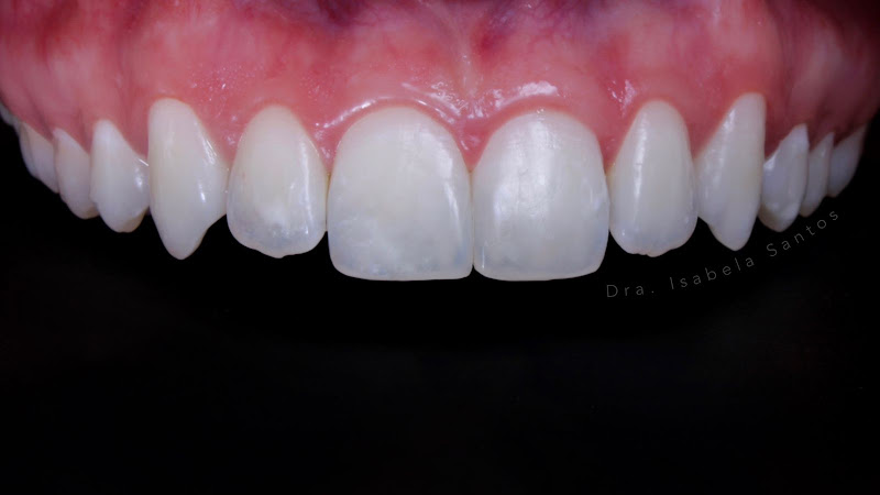 Foto 2 de Dra Isabela Santos - Cirurgiã Dentista