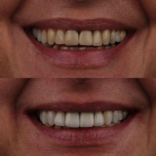 Foto 3 de Dra Isabela Santos - Cirurgiã Dentista