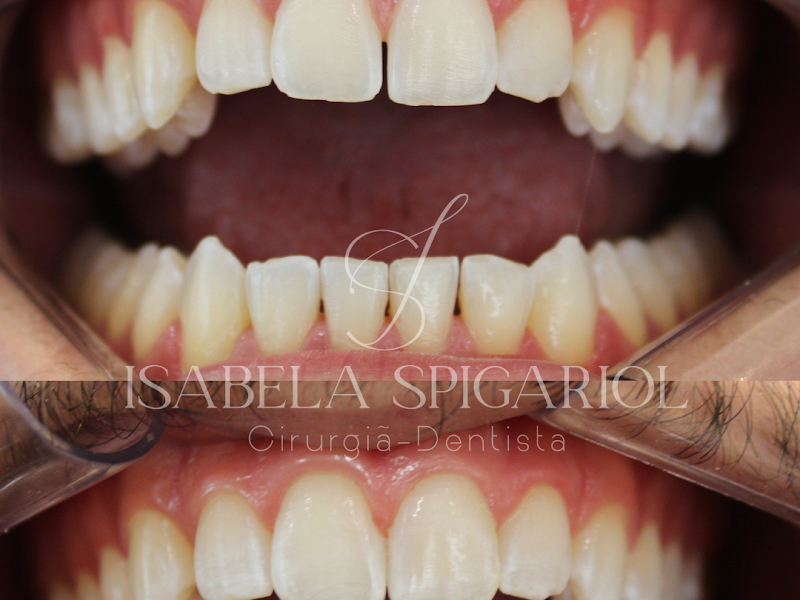 Foto de Dra. Isabela Spigariol - Odontologia Estética