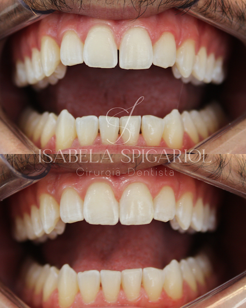Foto 2 de Dra. Isabela Spigariol - Odontologia Estética