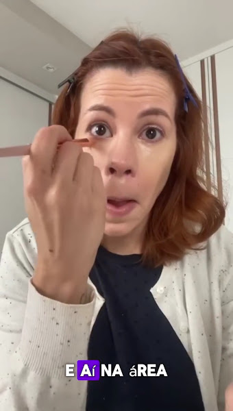 Foto 3 de Dra Isabela Wolf | Cirurgia das Pálpebras Blefaroplastia | Bucomaxilo em Indaiatuba