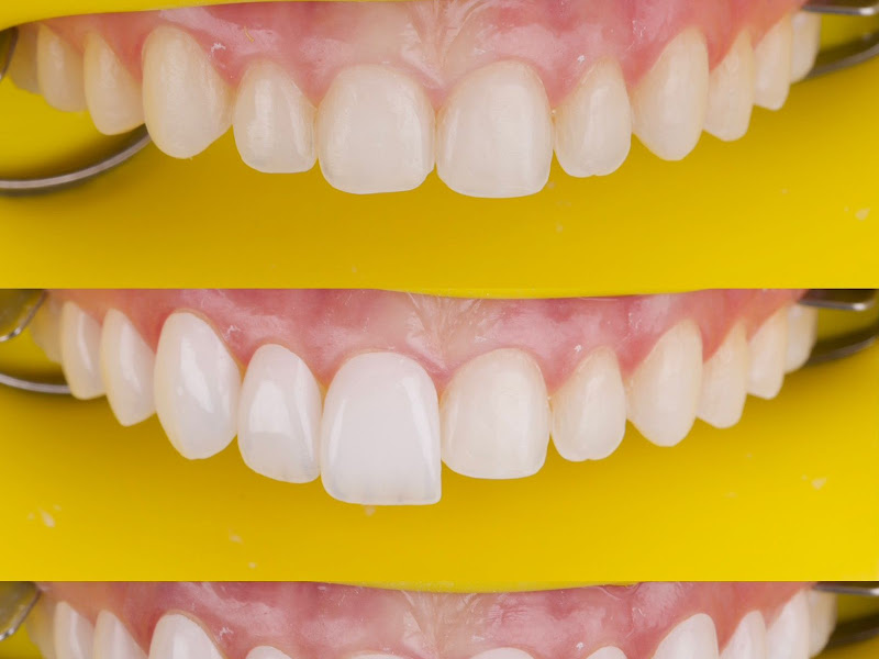 Foto 11 de Dra Isabella Cavaglieri | Dentista Mooca | Tatuapé