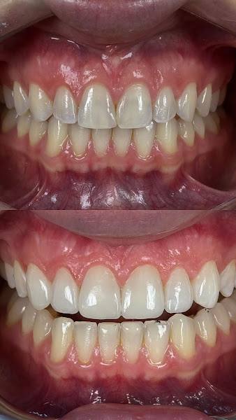 Foto 3 de Dra Isabella Girardelli Odontologia Estética & Facetas em Resina