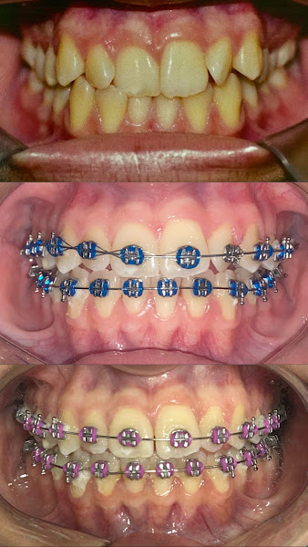 Foto 2 de Dra Isabelle Rany - Dentista ortodontista