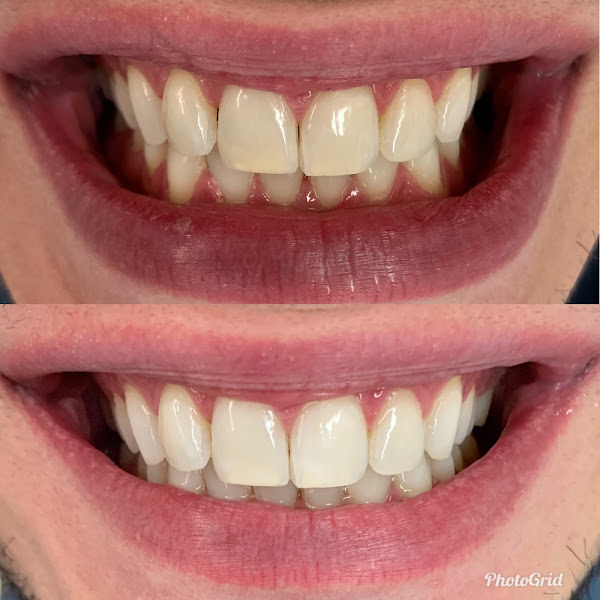 Foto 3 de Dra Isabelle Santa Cruz Dentista