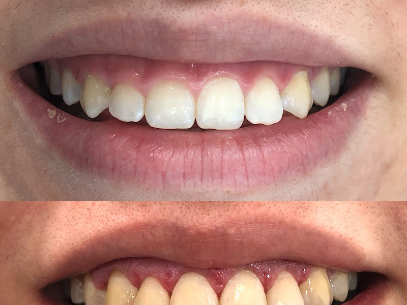 Foto 4 de Dra Isadora Aragão | Convênio | Dentista em Pirituba