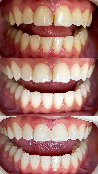 Foto 3 de Dra. Isadora Araújo Dentista