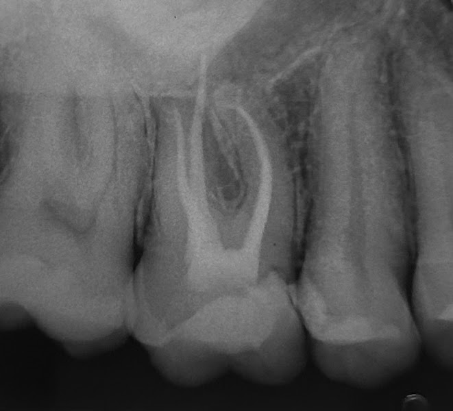 Foto 2 de Dra. Isadora Ferrari Teixeira - Endodontia
