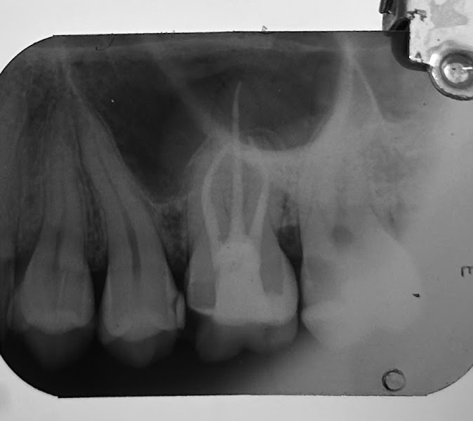 Foto 3 de Dra. Isadora Ferrari Teixeira - Endodontia
