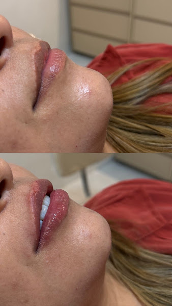 Foto 3 de Dra. Isadora Gomes - Harmonização Orofacial