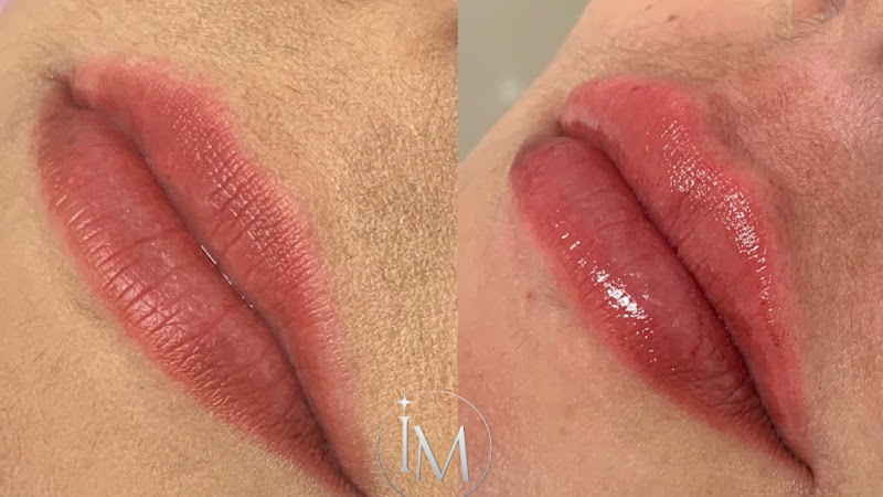 Foto de Dra. Isadora Mota - Harmonização Orofacial