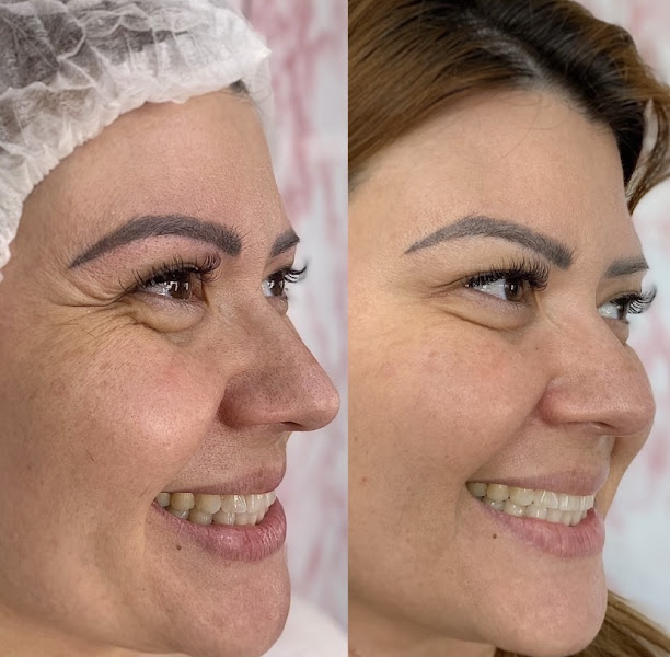 Foto 2 de Dra. Isadora Mota - Harmonização Orofacial
