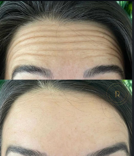 Foto 2 de Dra. Isadora Passaglia l Dentista | Harmonização Facial