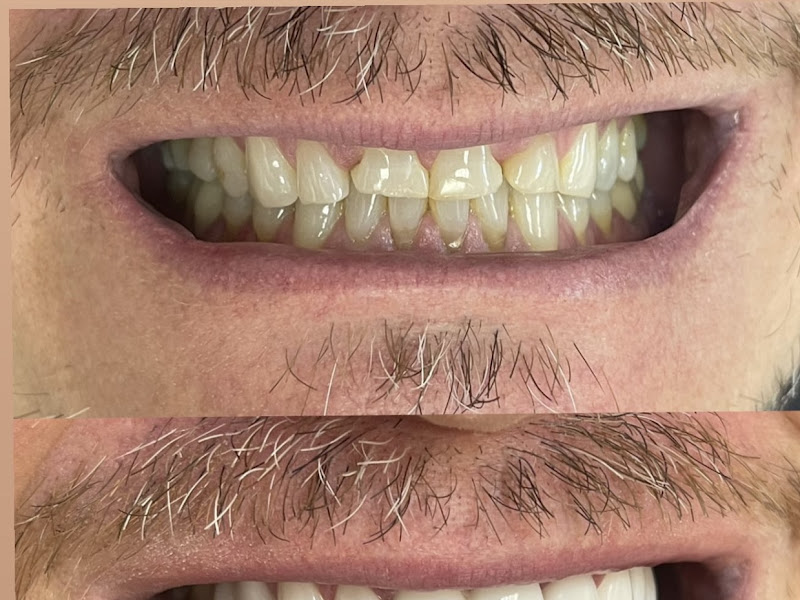 Foto 5 de Dra. Isadora Vioto | Harmonização Facial em Pinheiros