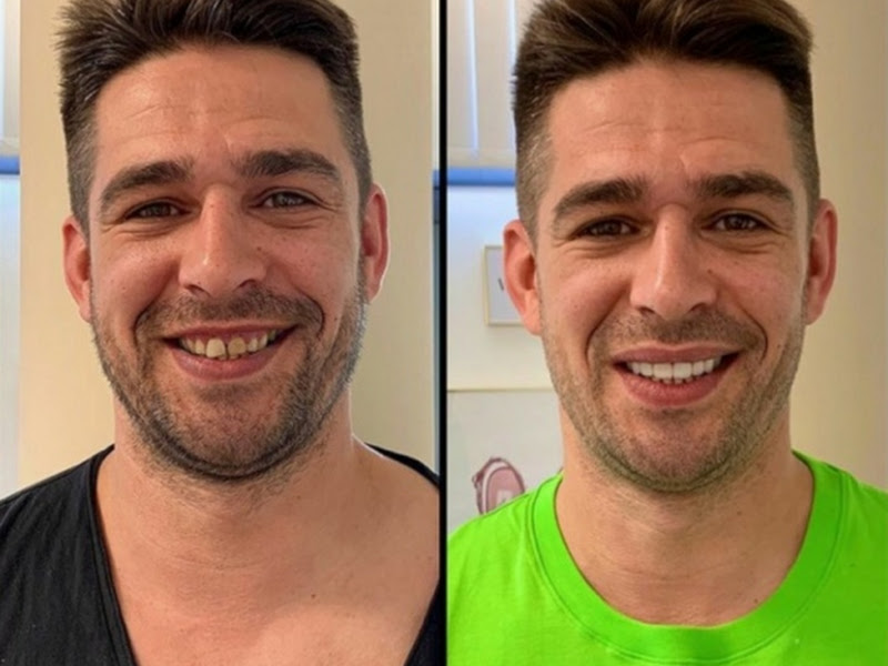 Foto 3 de Dra. Ivanilda - Tratamento de Canal | Clínica Odontológico