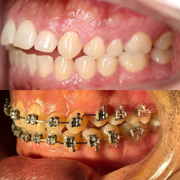 Foto 2 de Dra Ive Vaz - ORTODONTIA e ORTOPEDIA FACIAL