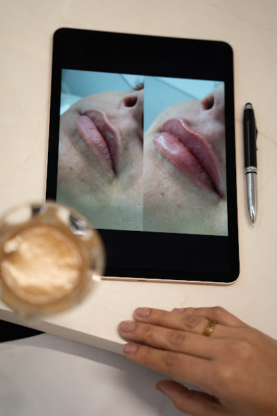 Foto 3 de Dra. Ivna Feijó | Estética especializada